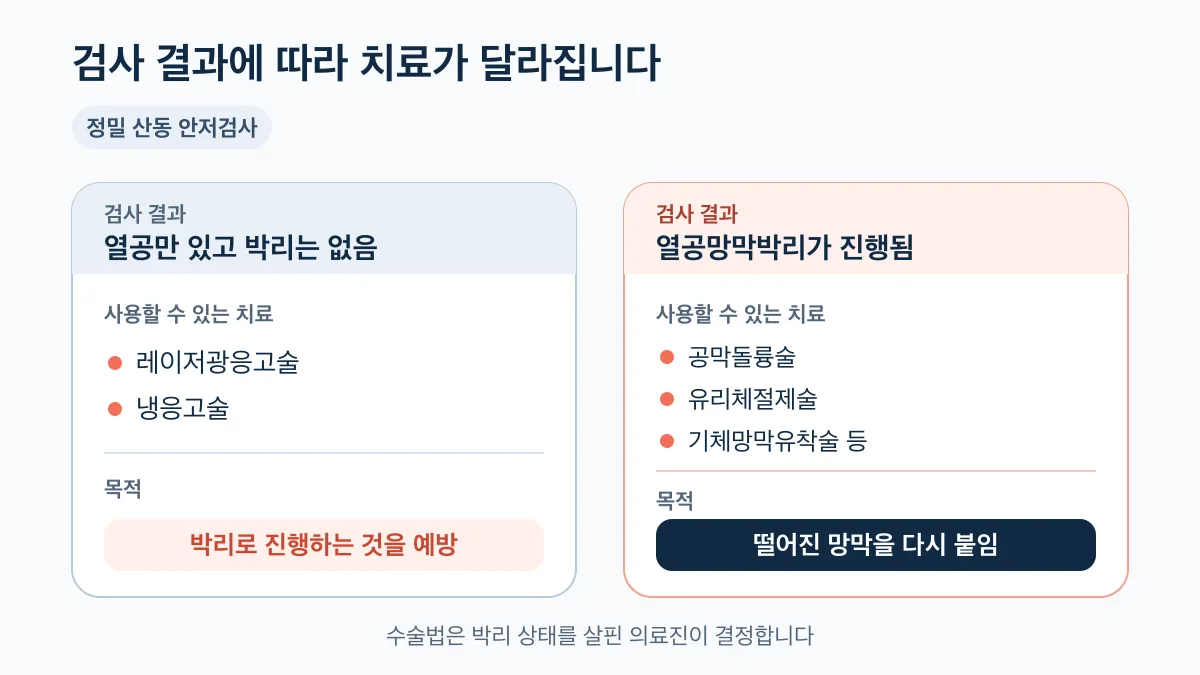 망막열공과 열공망막박리의 검사 결과별 치료 비교